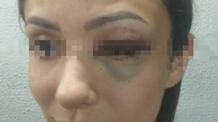 Carlene Nobre, foi espancada pelo namorado, que não teve a identidade revelada