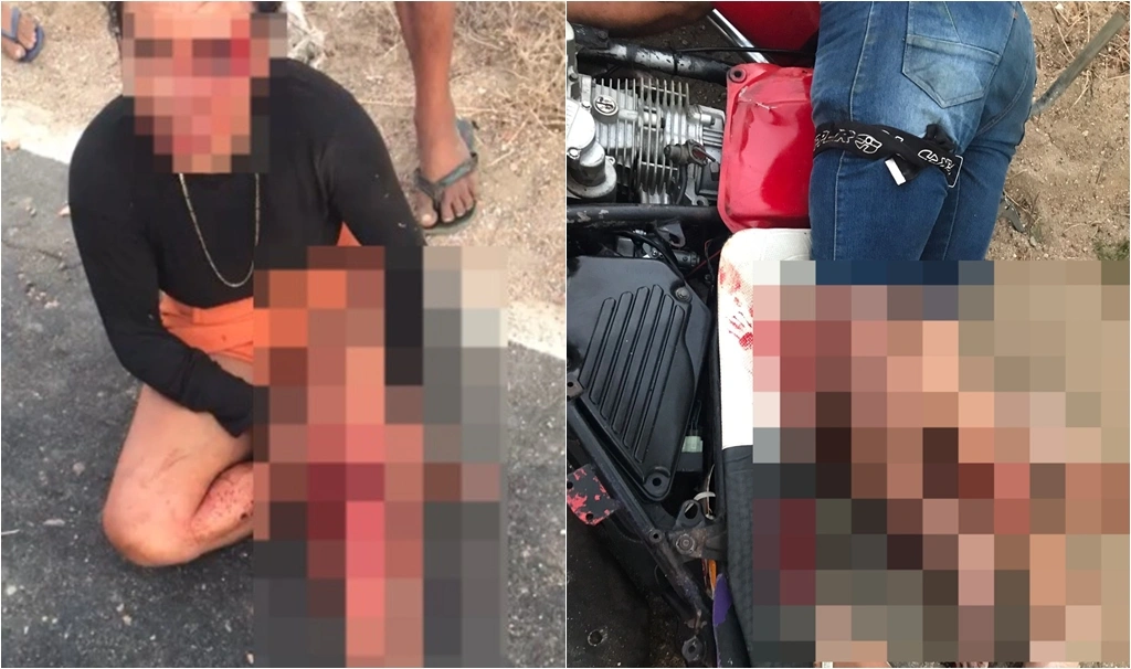 Casal ficou com ferimentos graves após colisão