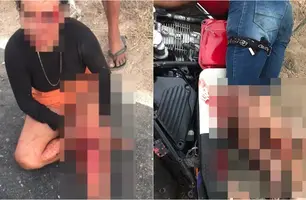 Casal ficou com ferimentos graves após colisão (Foto: Reprodução)