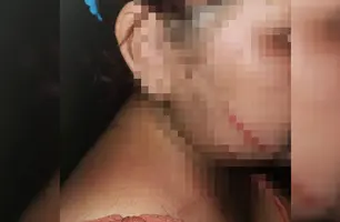 Grávida foi espancada (Foto: Reprodução)