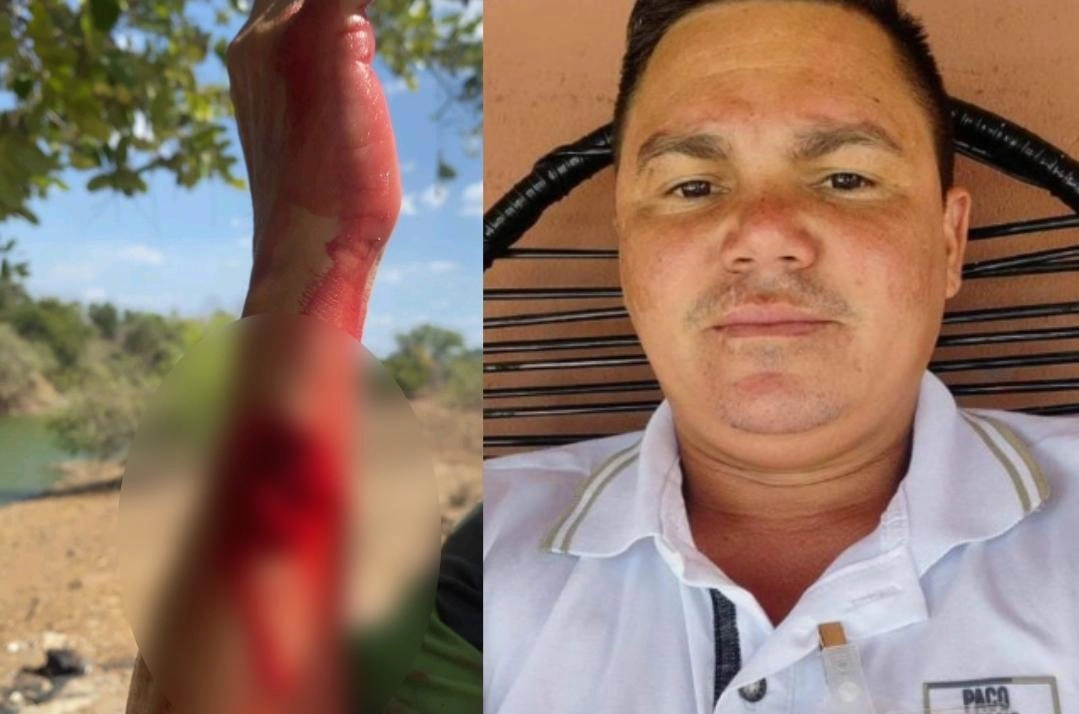 Homem é atacado por piranha durante pescaria em Campo Maior