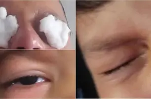 Reação sofrida pelas crianças (Foto: Reprodução)