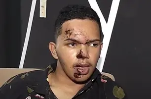 Rosto do blogueiro Lokinho após o acidente (Foto: Reprodução)