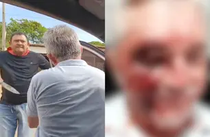 Vereador de Cocal da Estação esfaqueia blogueiro Godofredo Brito (Foto: Reprodução / Redes Sociais)