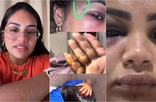 Andressa Lopes (Foto: Reprodução)