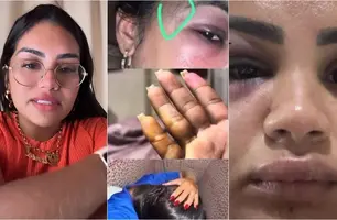 Andressa Lopes (Foto: Reprodução)