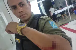 Policial militar é baleado por criminoso durante abordagem em Teresina (Foto: Reprodução)