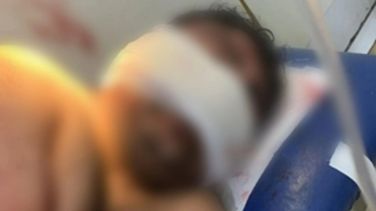 Anacleto em hospital após sofrer agressões