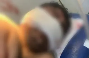 Anacleto em hospital após sofrer agressões (Foto: Reprodução)