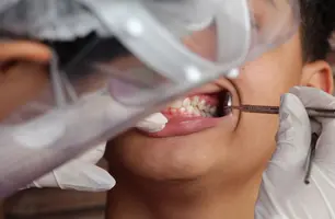 Brasil Sorridente será relançado nesta segunda pelo governo (Foto: Laísa Queiroz/MS)