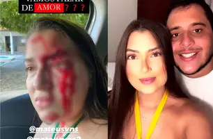 Jovem foi agredida pelo namorado em Teresina (Foto: Reprodução/ Instagram)