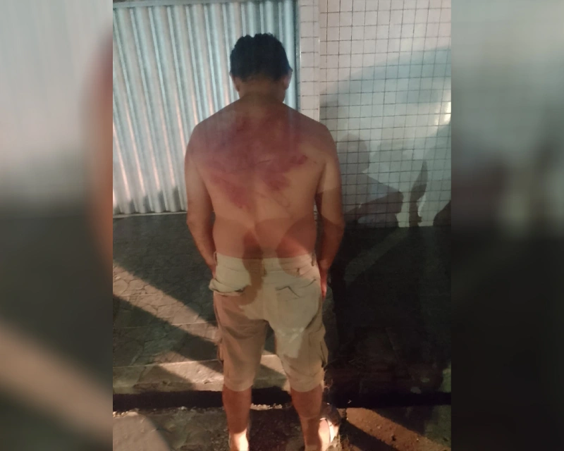 Homem bastante machucado após sequestro
