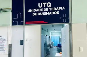 Unidade de Tratamento de Queimados (UTQ) do Hospital de Urgência de Teresina (HUT) (Foto: Divulgação/ Prefeitura de Teresina)