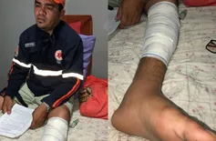 Motorista do Samu baleado em atendimento cobra regulamentação da função