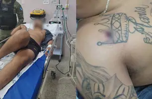 Homem é baleado no ombro (Foto: Reprodução/ Redes Sociais)