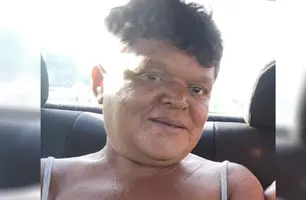 Mulher morre atropelada no Piauí (Foto: Reprodução/ Redes Sociais)