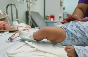 Sesapi vai abrir leitos pediátricos para enfrentamento de síndromes respiratórias (Foto: Divulgação/Ascom)