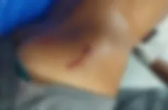 Homem é baleado durante tiroteio no residencial Dilma Rousseff em Teresina