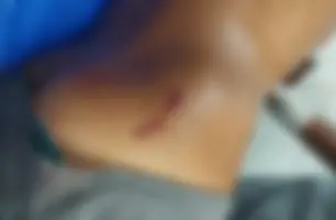 Baleado (Foto: Conecta Piauí)