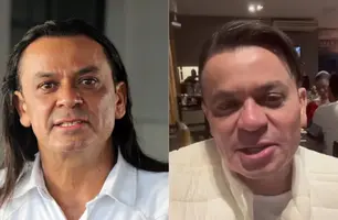 Frank Aguiar passa por harmonização e novo corte de cabelo (Foto: Reprodução)
