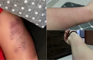 Jovem é agredida por ex-companheiro e sofre tentativa de feminicídio (Foto: Reprodução)