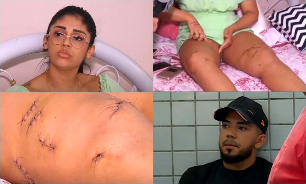 Jovem mostra perfurações