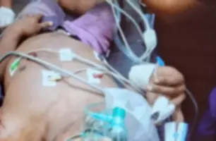 Jovem é baleado em Demerval Lobão (Foto: Reprodução)