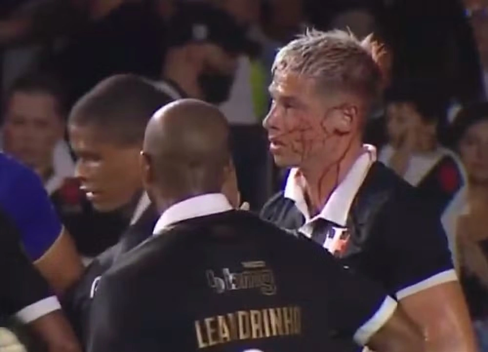 Capasso leva cotovelada durante jogo