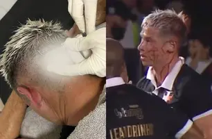 Capasso leva cotovelada durante jogo (Foto: Reprodução/Instagram)