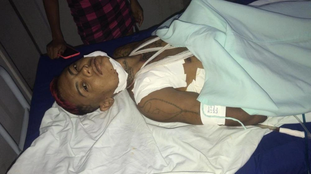 'Crânio' foi levado ao hospital em estado grave
