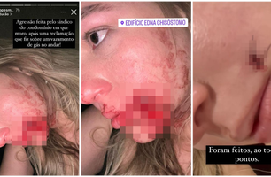 Modelo acusa síndico de agressão em condomínio na zona Leste de Teresina (Foto: Reprodução)