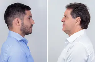 Empate técnico: veja a acirrada disputa pela prefeitura de Fortaleza no 2º turno (Foto: Reprodução)