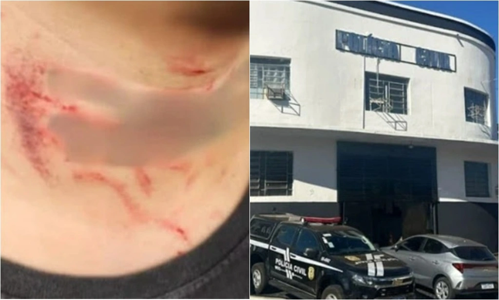 Homem é estuprado e agredido por namorado de amiga