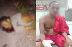 Homem é morto e jovem fica ferido em tiroteio em Demerval Lobão (Foto: Reprodução)