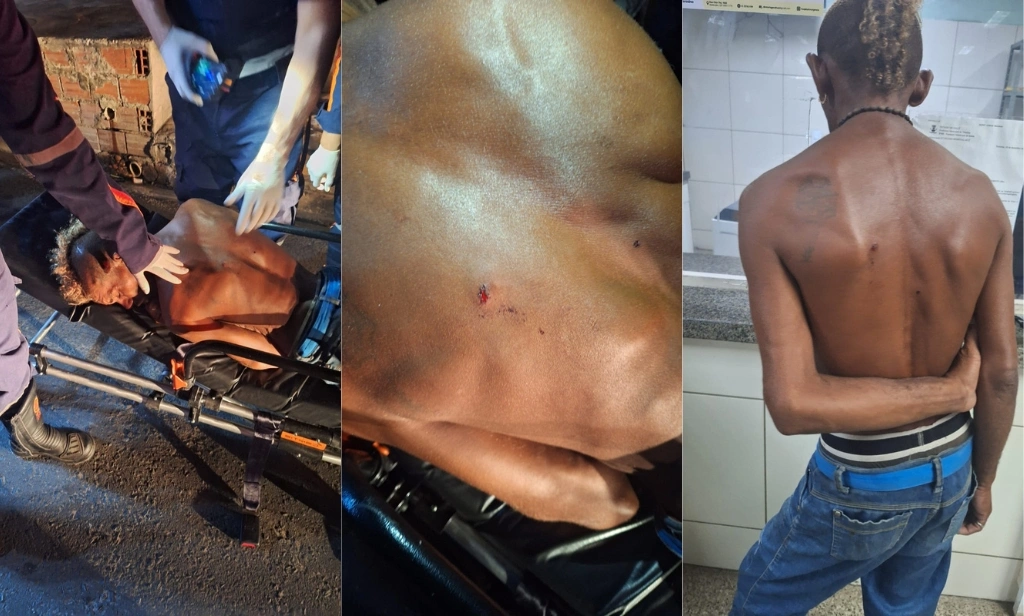Homem é socorrido após afirmar ter sido baleado nas costas na zona Sul de Teresina