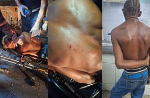 Homem é socorrido após afirmar ter sido baleado nas costas na zona Sul de Teresina (Foto: Reprodução)