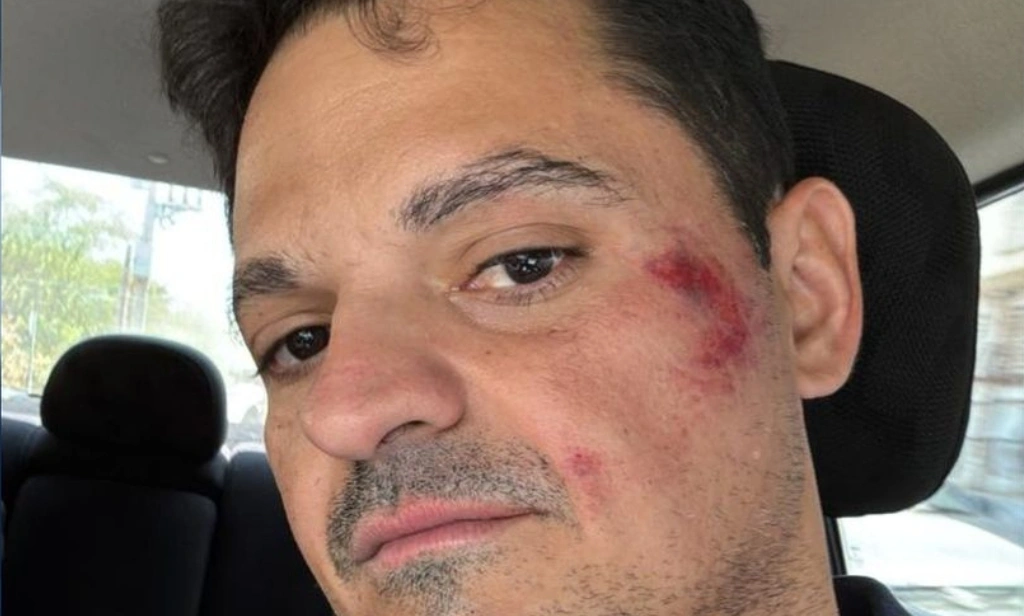 Jornalista é agredido durante cobertura das Eleições 2024 em São Raimundo Nonato