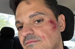 Jornalista é agredido durante cobertura das Eleições 2024 em São Raimundo Nonato (Foto: Reprodução)