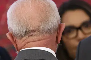 Lula faz exames em Brasília e apresenta quadro estável (Foto: Marcelo Camargo/Agência Brasil)