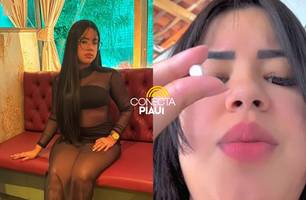 Operação Jogo Sujo: influencer solta diz ter contraído sarna em presídio no Piauí (Foto: Reprodução)