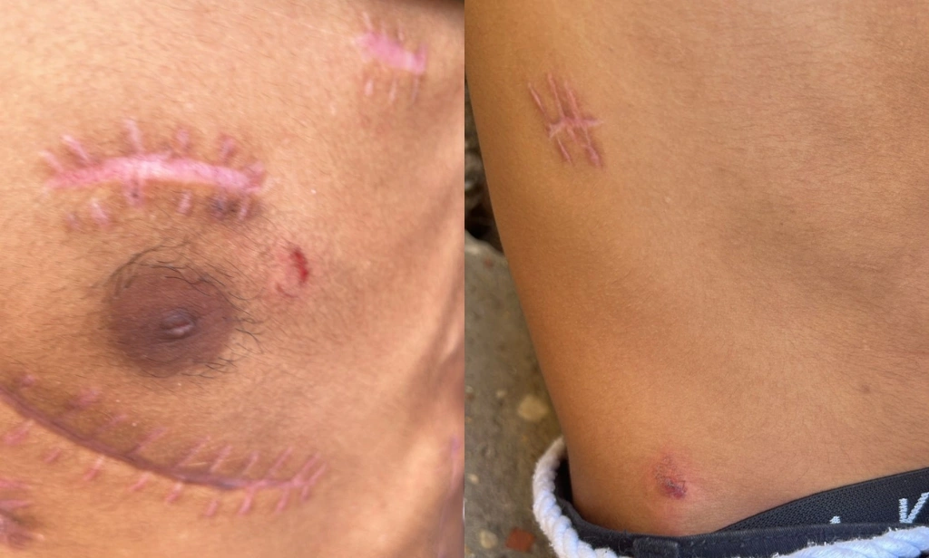 Criminosos acreditam que adolescente alvo de ataque em Teresina é suposto delator