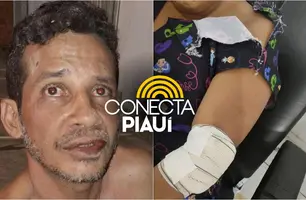 Mulher é esfaqueada pelo próprio companheiro em Demerval Lobão (Foto: Reprodução)