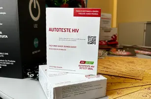 Teste rápido de HIV (Foto: Reprodução)