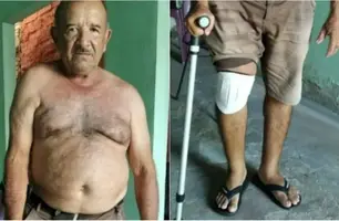 "Zezim" Messias foi assaltado e espancando dentro de casa em Barras (Foto: Reprodução)