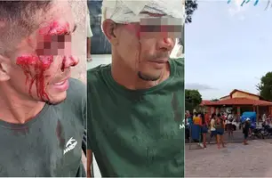 Homem denuncia que foi agredido por comandante da Polícia Militar em bar no Piauí (Foto: Reprodução)
