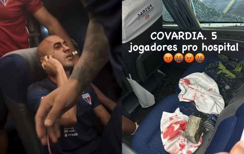 Jogadores ficam feridos após ataque a ônibus do Fortaleza