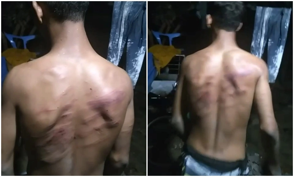 Mãe denuncia agressão sofrida pelo filho