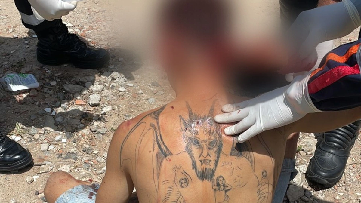 'Tem o diabo nas costas': homem sobrevive a vários tiros na cabeça