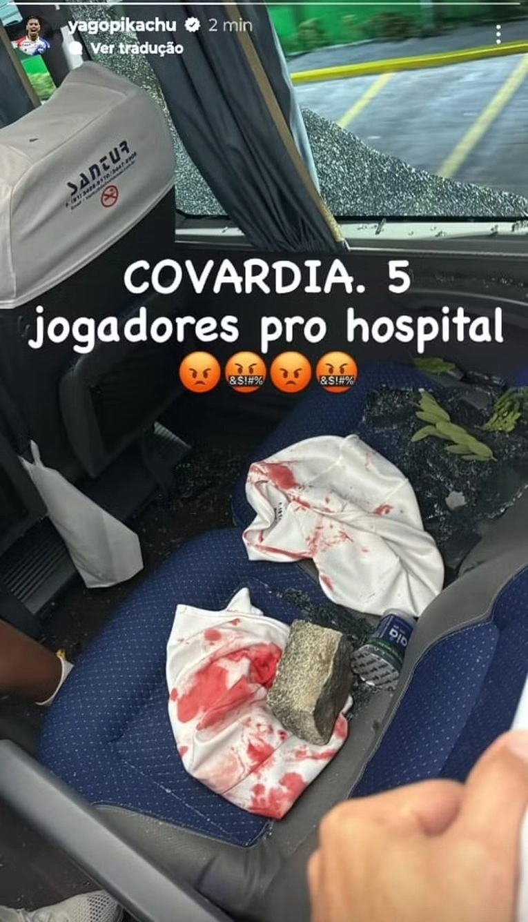 Yago Pikachu mostra pedra e encosto com sangue após ataque de torcedores