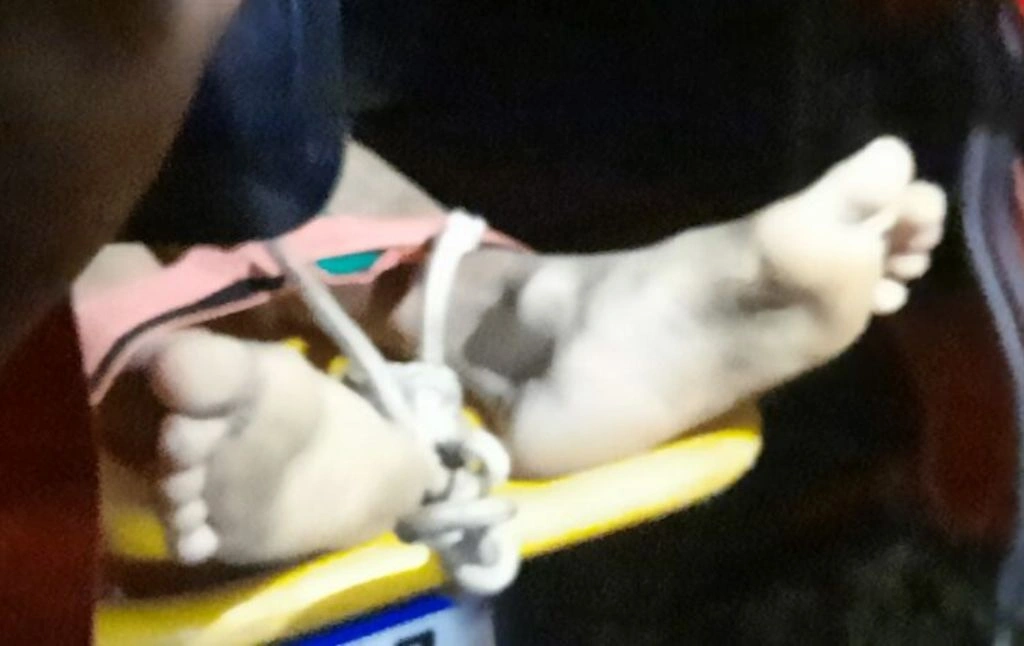 Adolescente é atingido por pedra após cair de cachoeira em cidade no Piauí